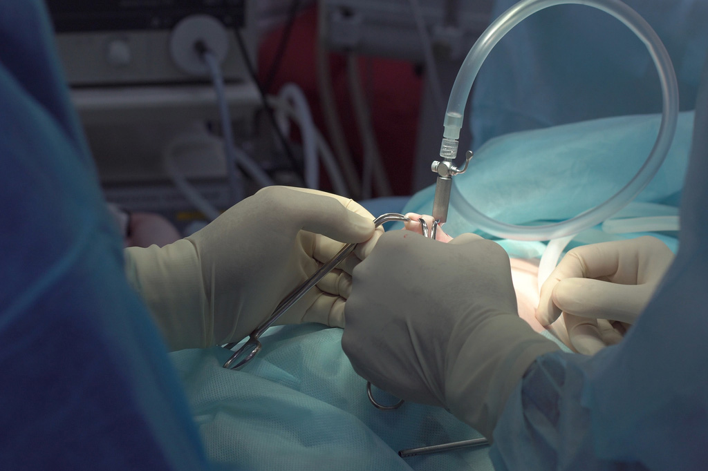 umbilical-hernia-surgery-what-to-expect-from-a-patient-s-perspective